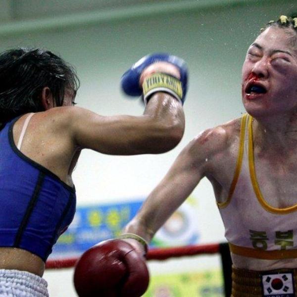 Boxe femme blessure oeil