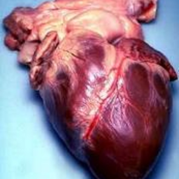 Coeur humain  1  orig