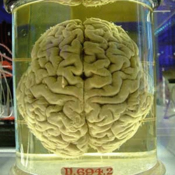 Cerveau humain 500