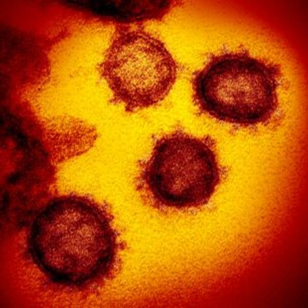 Coronavirus14